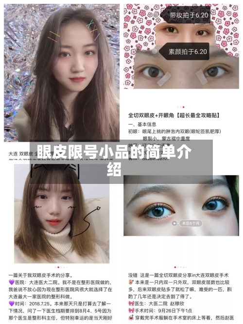 眼皮限号小品的简单介绍