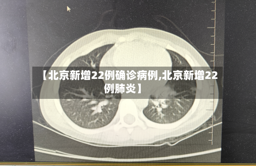 【北京新增22例确诊病例,北京新增22例肺炎】
