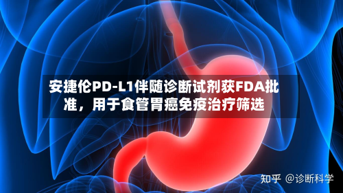 安捷伦PD-L1伴随诊断试剂获FDA批准，用于食管胃癌免疫治疗筛选