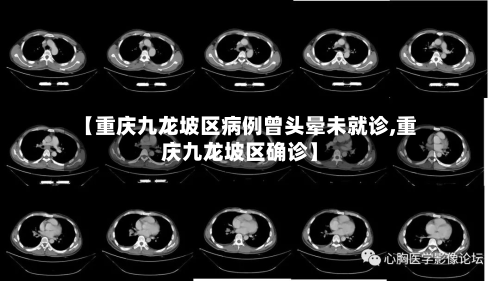 【重庆九龙坡区病例曾头晕未就诊,重庆九龙坡区确诊】